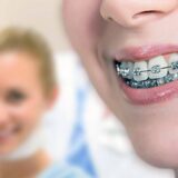 Ортодонтия: Ключевые Аспекты и Польза для Здоровья Улыбки